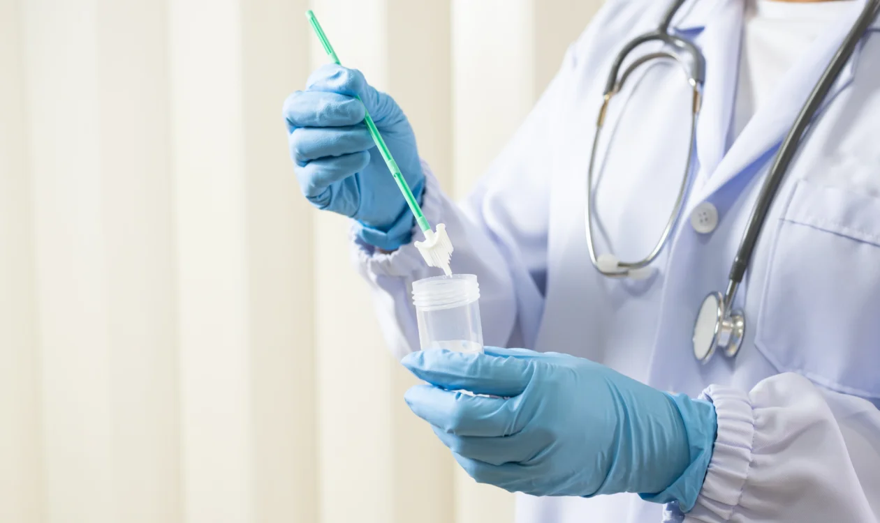Doctor is holding a cervical screening test kit with gloved hands.