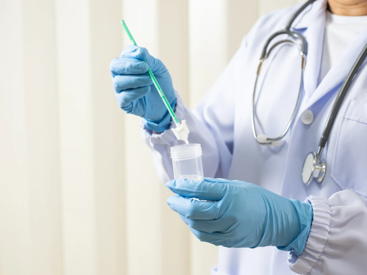 Doctor is holding a cervical screening test kit with gloved hands.