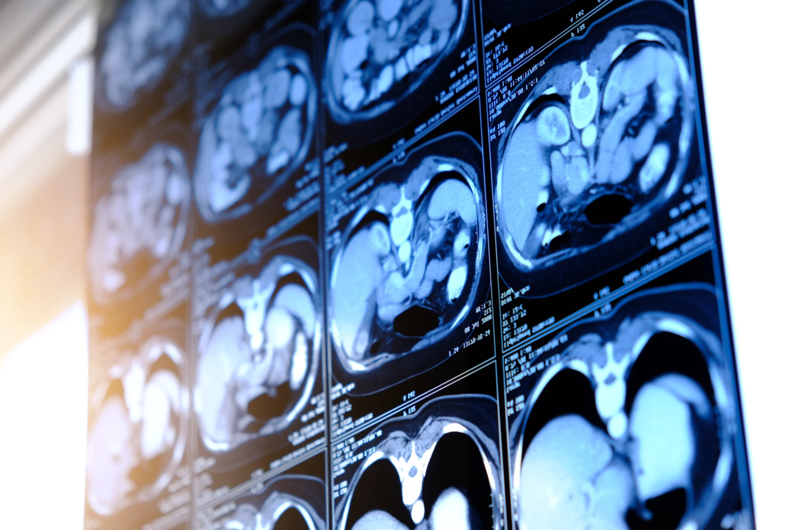 Screen of kidney scans