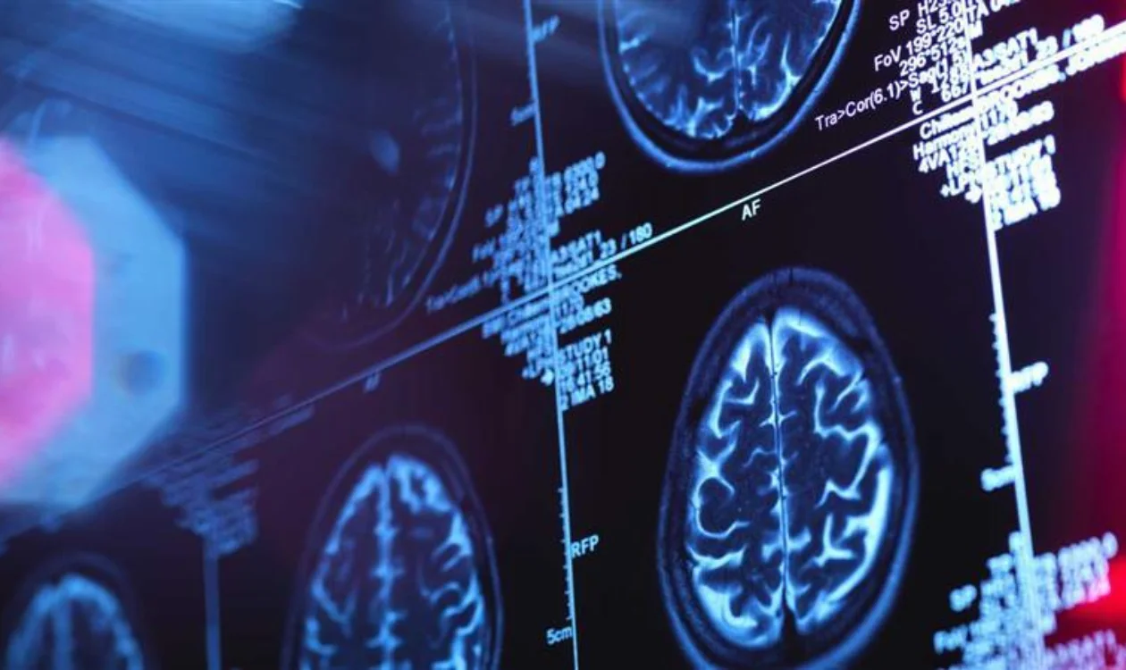 Brain scan on a screen