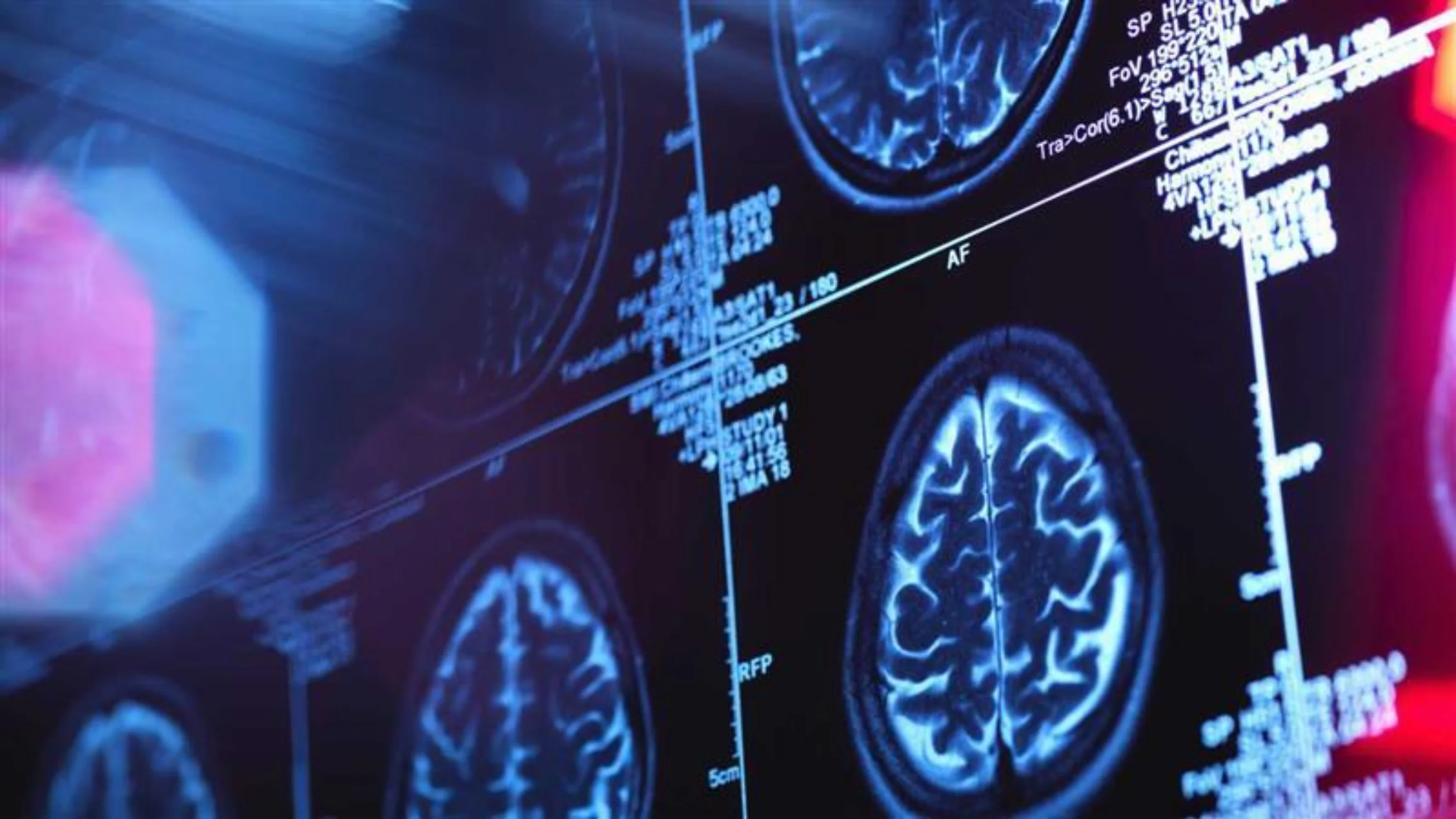 Brain scan on a screen