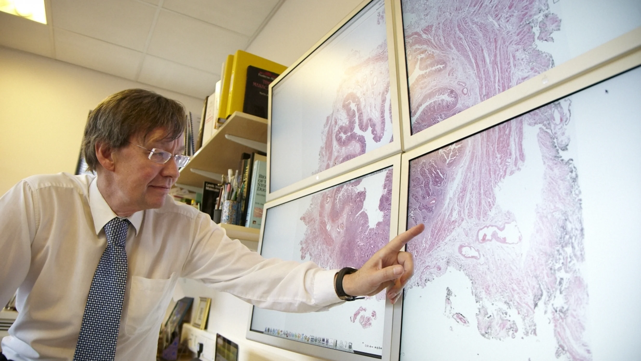 Researcher Phil Quirke pointing at a large screen displaying a scan.