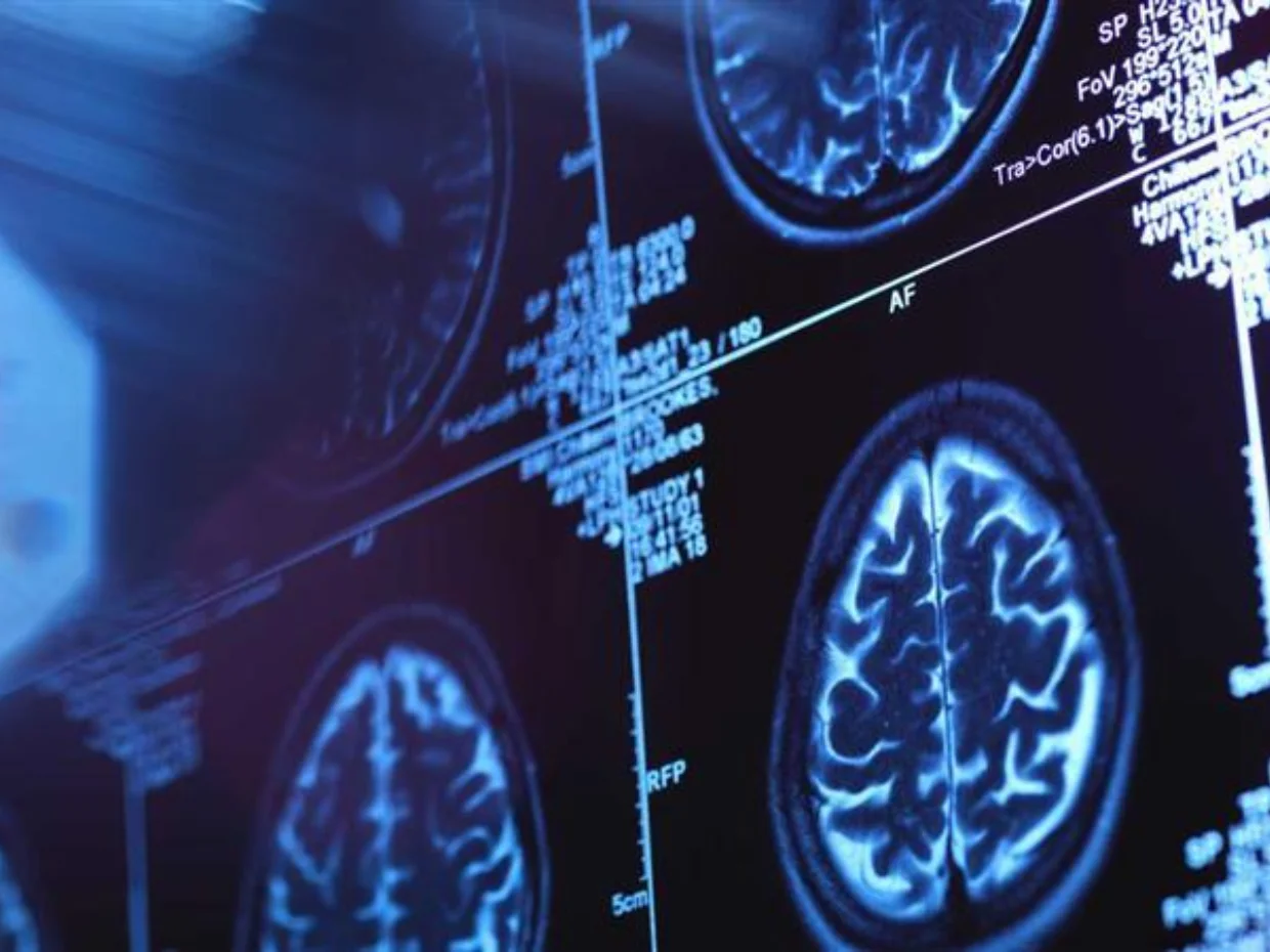 Brain scan on a screen