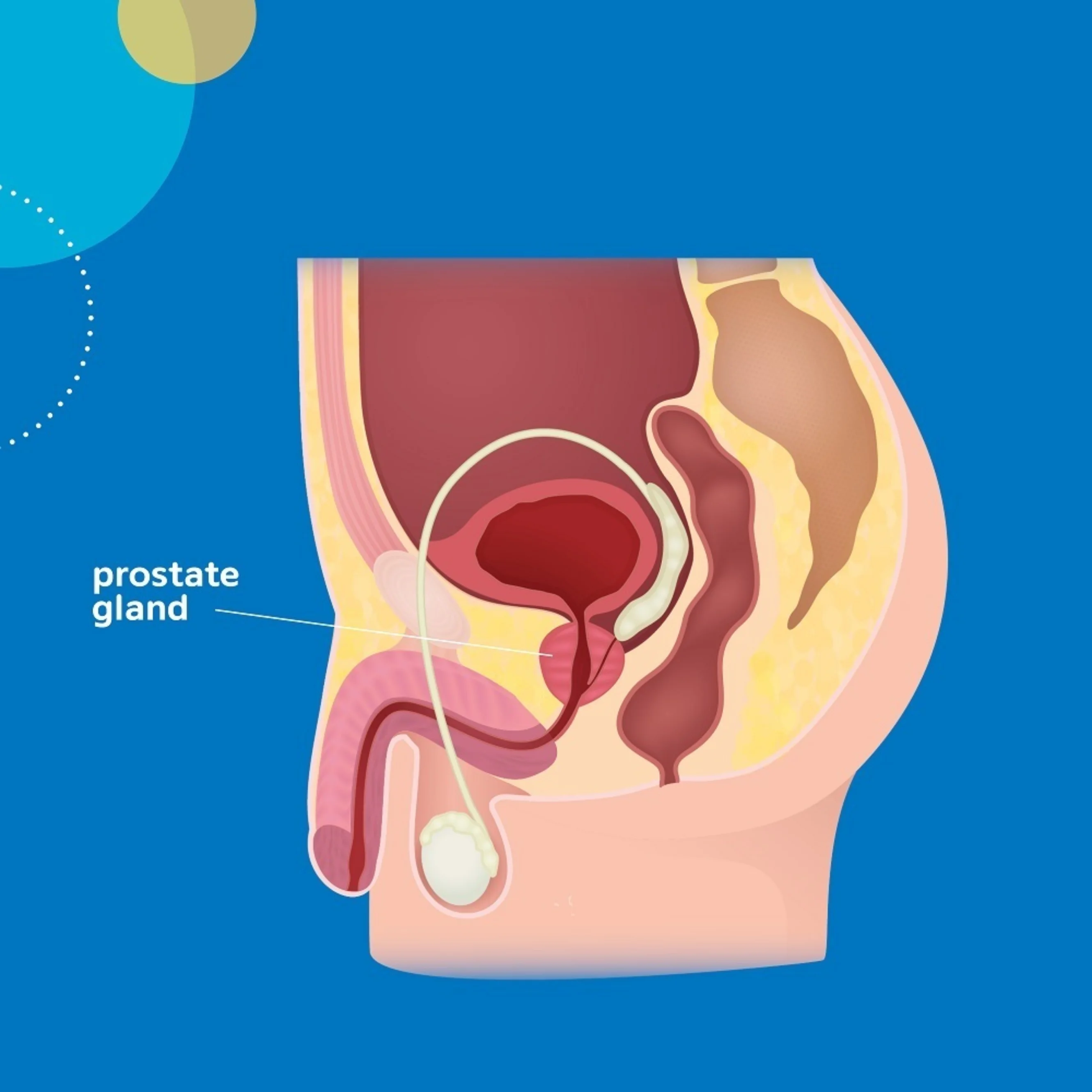 prostate About prostate cancer - Yorkshire Cancer Research