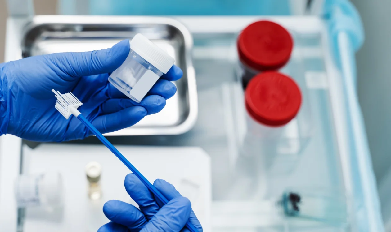 Gloved hands are holding a flask and a brush for a pap smear test.