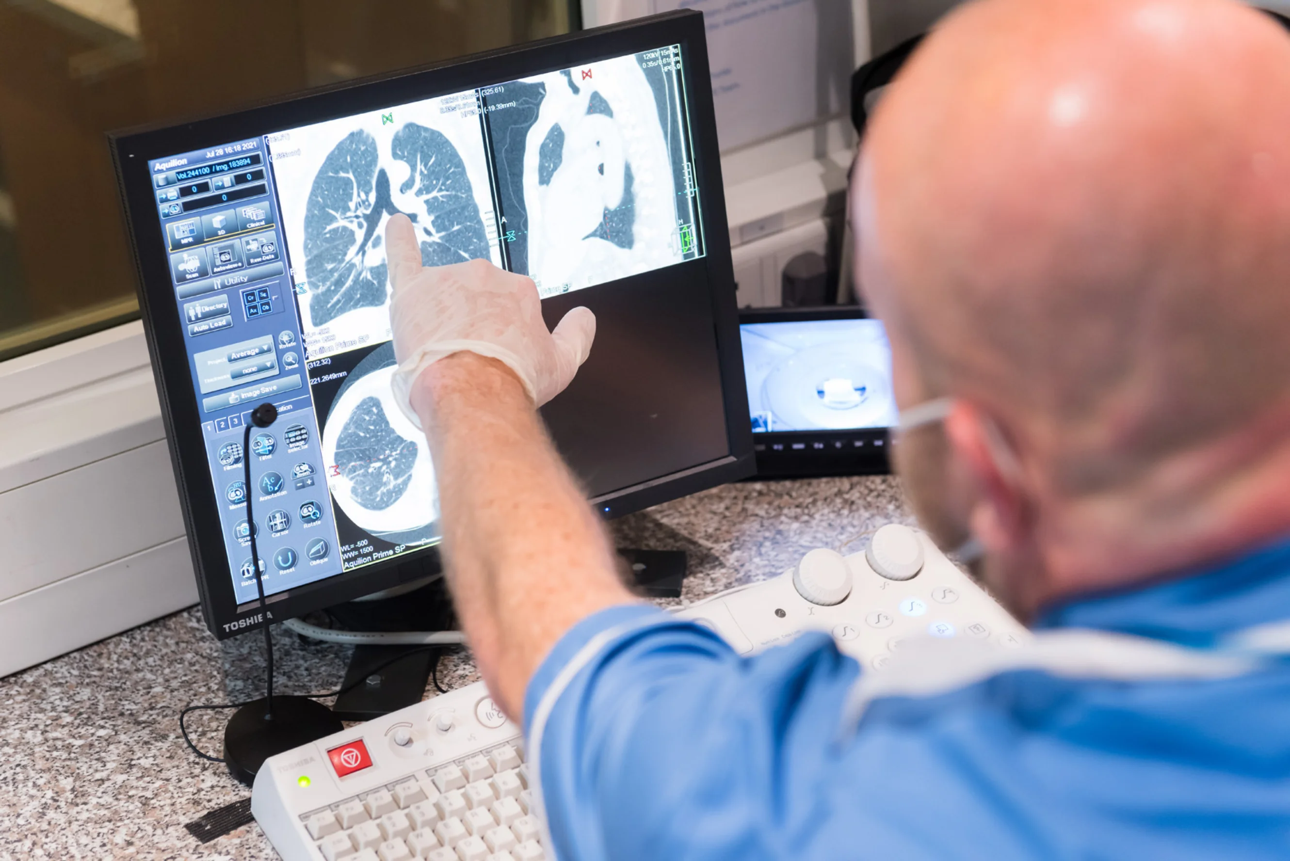 A radiologist examines a lung scan