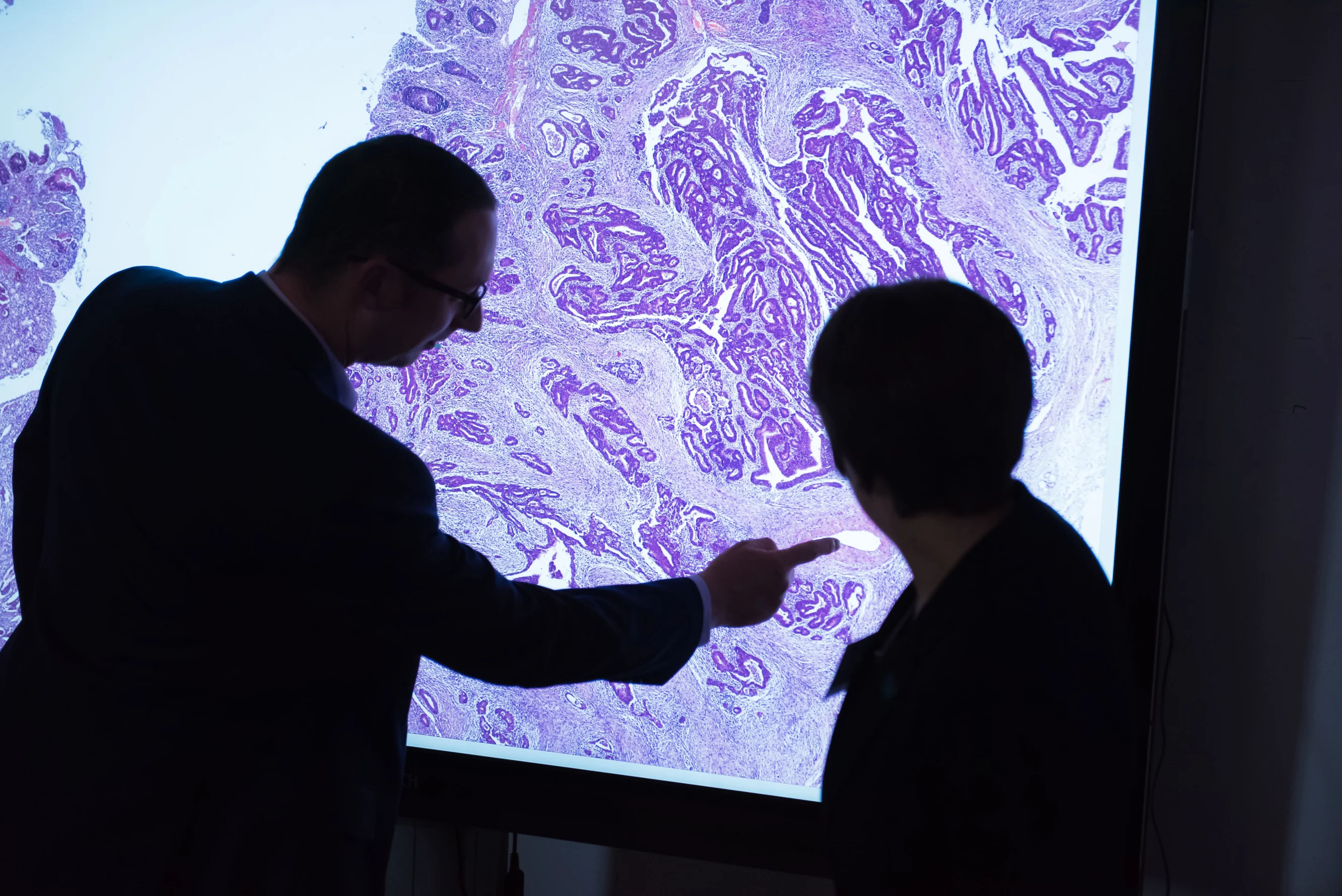 The Bowel Cancer Improvement Programme powerwall.