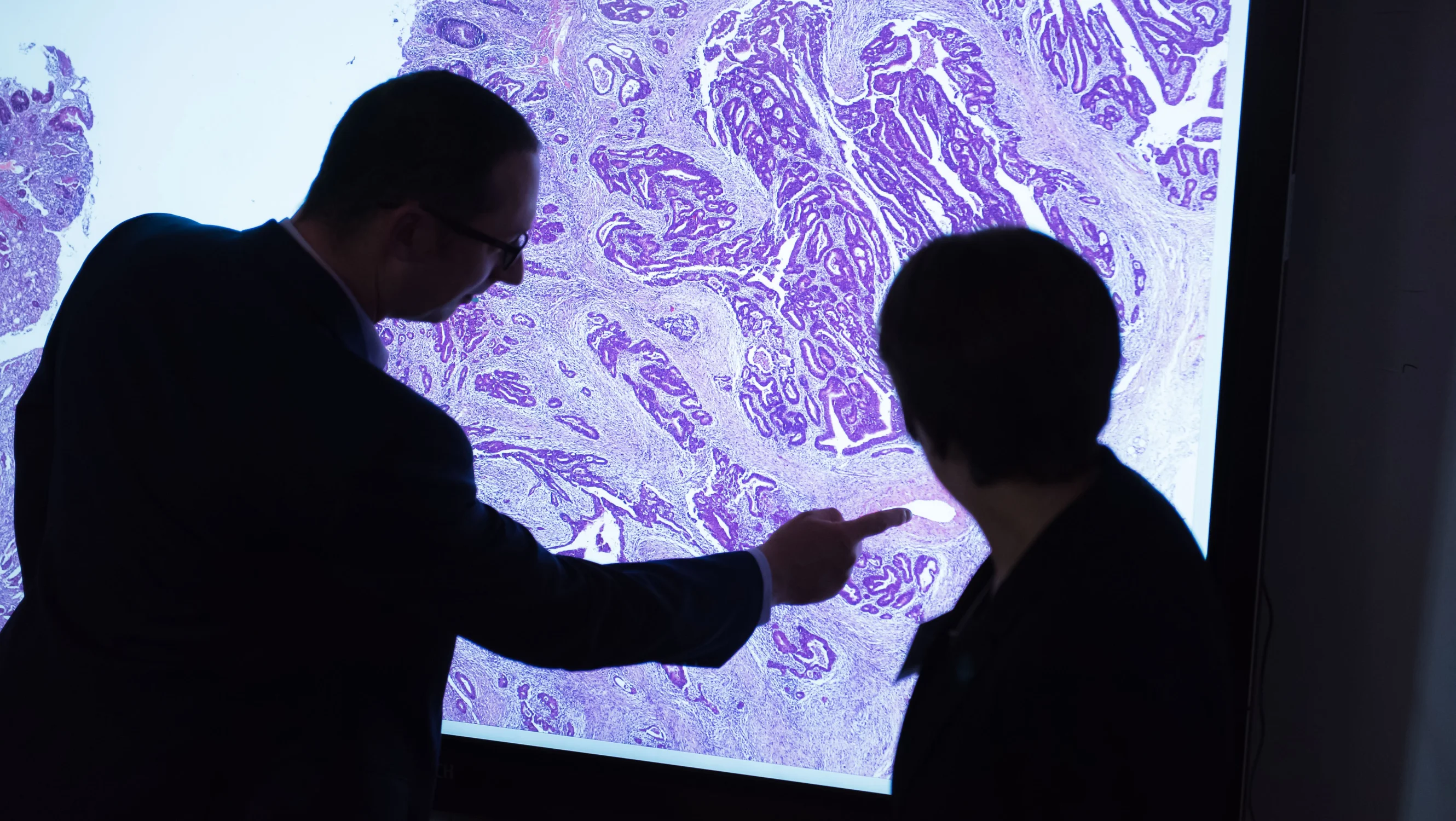 Two men pointing at a bowel cancer scan