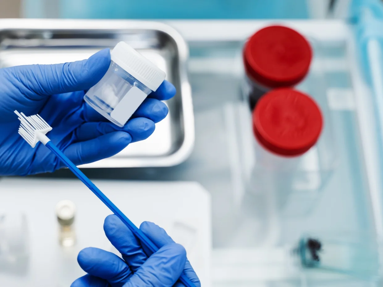 Gloved hands are holding a flask and a brush for a pap smear test.